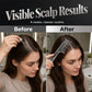 📢📢Buy 1 Get Free 1 !! ⏰ Scalp Applicator Comb Tool for Hair